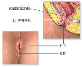 肛門痛