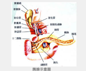 自身免疫性胰腺炎