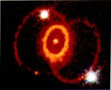 SN1987A