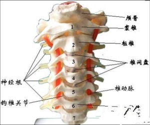 頸椎病