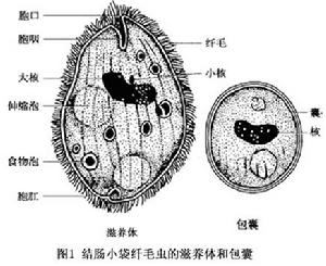 小袋纖毛蟲病