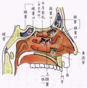 小兒咽結合膜熱