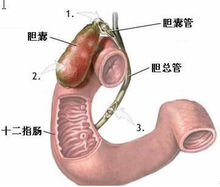 【苗嶺舒胃方】治療胃潰瘍