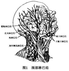 頸淋巴結結核