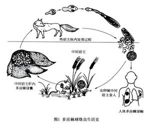 多房棘球蚴病