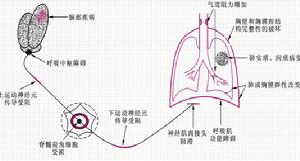 《呼吸系統疾病的病理生理》