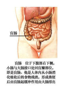 慢性闌尾炎