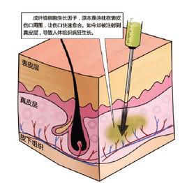 人類生長因子