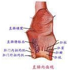 膽道出血