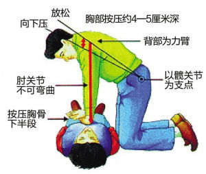 心肺復甦術[急救技術]