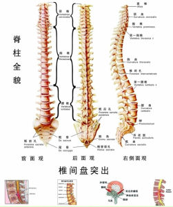 腰椎間盤突出