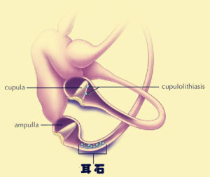 耳石脫落