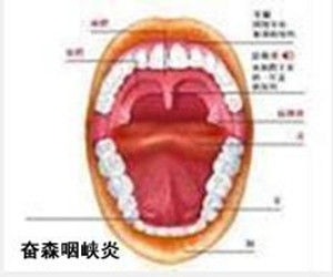 奮森氏螺旋體