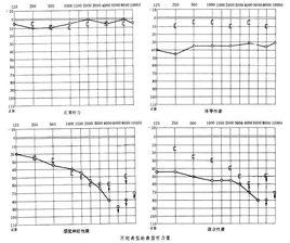 點式聽力法