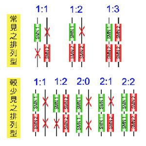 脊髓性肌肉萎縮症