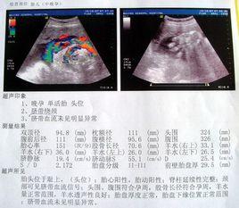 B超檢查報告單