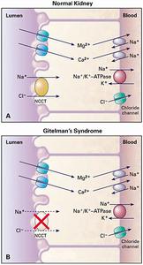 Gitelman綜合徵