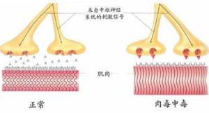 外毒素