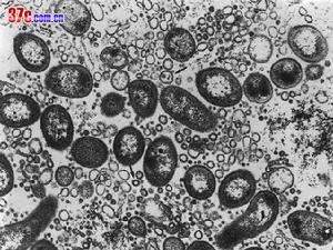 慢性非特異性潰瘍性結腸炎