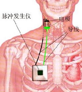 皮克病