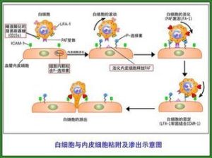 小兒白細胞黏附分子缺陷Ⅰ型