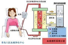 血液淨化