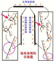 染色體倒點陣圖解