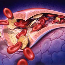 “鐮狀細胞貧血病”的細胞組織