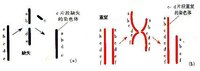 染色體結構變異