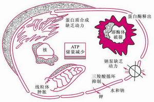 類鼻疽