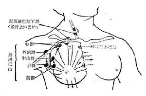 腋窩外側淋巴結