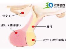 老年異位抗利尿素分泌綜合症