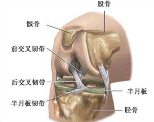 半月板損傷類型