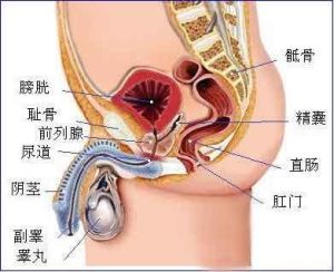 睪丸囊腫