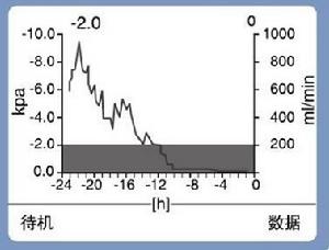 數字式胸腔引流系統