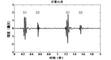 圖4 正常心音