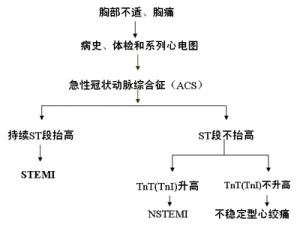 變異型心絞痛