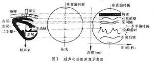 超聲心動圖