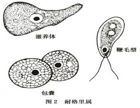 棘阿米巴性角膜炎