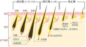 雷射脫毛法