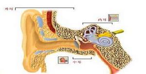 （圖）耳硬化