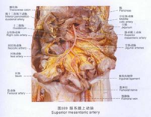 腸系膜動脈瘤