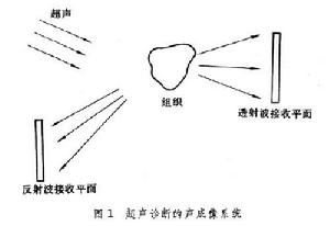 醫學超聲