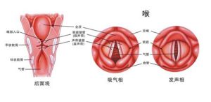 咽炎