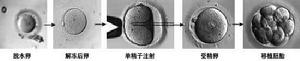 卵子冷凍人工授精技術圖示