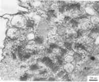 感染萵苣壞死黃化病毒的克利夫蘭菸葉肉細胞