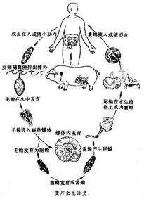 薑片蟲病