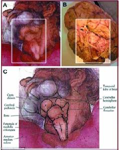 壁畫中上帝的脖子（A）畫得十分精細，紋理與大腦解剖圖（B）吻合。