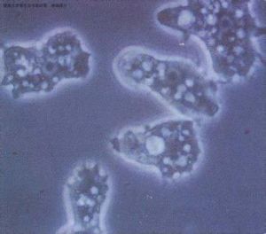 食腦阿米巴原蟲