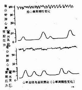 心率過速